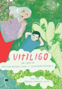 Vitiligo